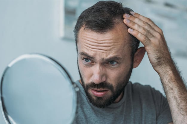 Saç Dökülmesiyle Nasıl Başa Çıkılır?